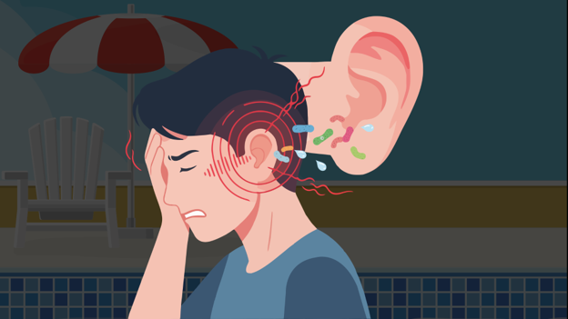 Ear care after a pool dare